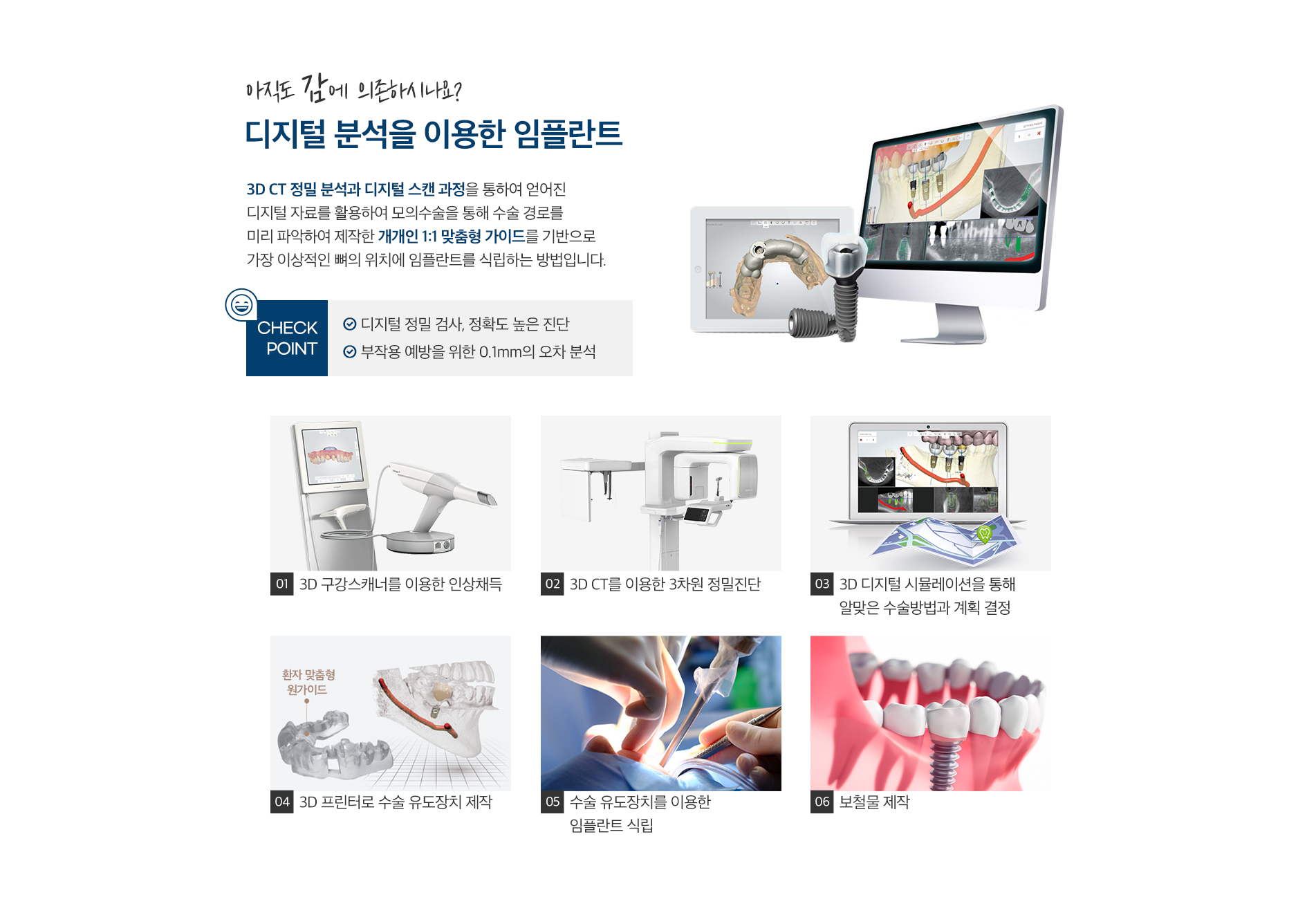 금광동 치과 임플란트 3D 계획 소프트웨어 화면